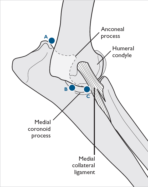 Een kijkoperatie in het gewricht kan mooie beelden opleveren van OCD letsels en losse stukken beenderen, zoals LPC. Het is een techniek die veel minder traumatisch is dan arthrotomie.