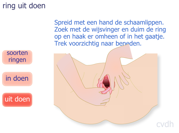 Uithalen Zoek met uw duim en vinger de ring op en haak aan in de