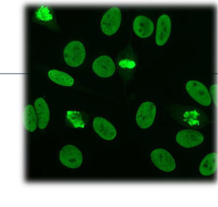 Overzicht bepalingsmethoden ANA IIF op HEp2(000)-cellen Peene et al.