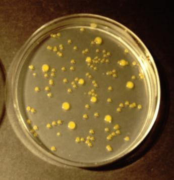 (anthrax) as agents of disease 1881: solid culture media for isolation of bacteria