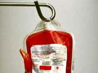 ALS VERPLEEGKUNDIGE MOET JE OP DE HOOGTE ZIJN VAN: Werkwijze voor tijdens en na transfusie Hoe