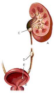 Urologie Ureterorenoscopie (URS) Verwijdering van stenen in de urineleider Inleiding U heeft van uw arts vernomen dat u een niersteen in uw urineleider of nierbekken heeft.