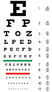 Diagnose van diabetische retinopathie (DR) en diabetisch macula-oedeem (DME) Alleen een oogarts kan de