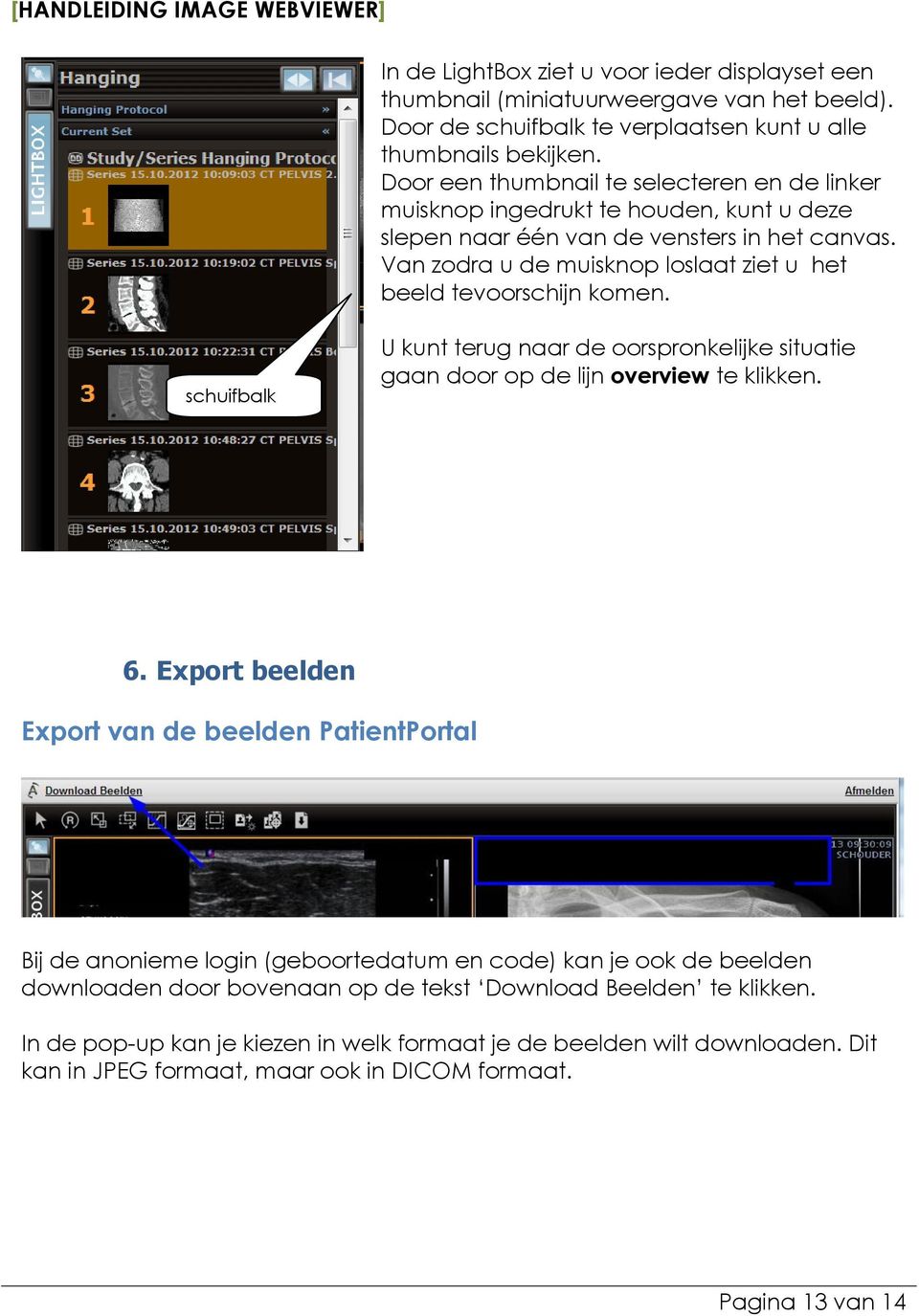 Van zodra u de muisknop loslaat ziet u het beeld tevoorschijn komen. schuifbalk U kunt terug naar de oorspronkelijke situatie gaan door op de lijn overview te klikken. 6.