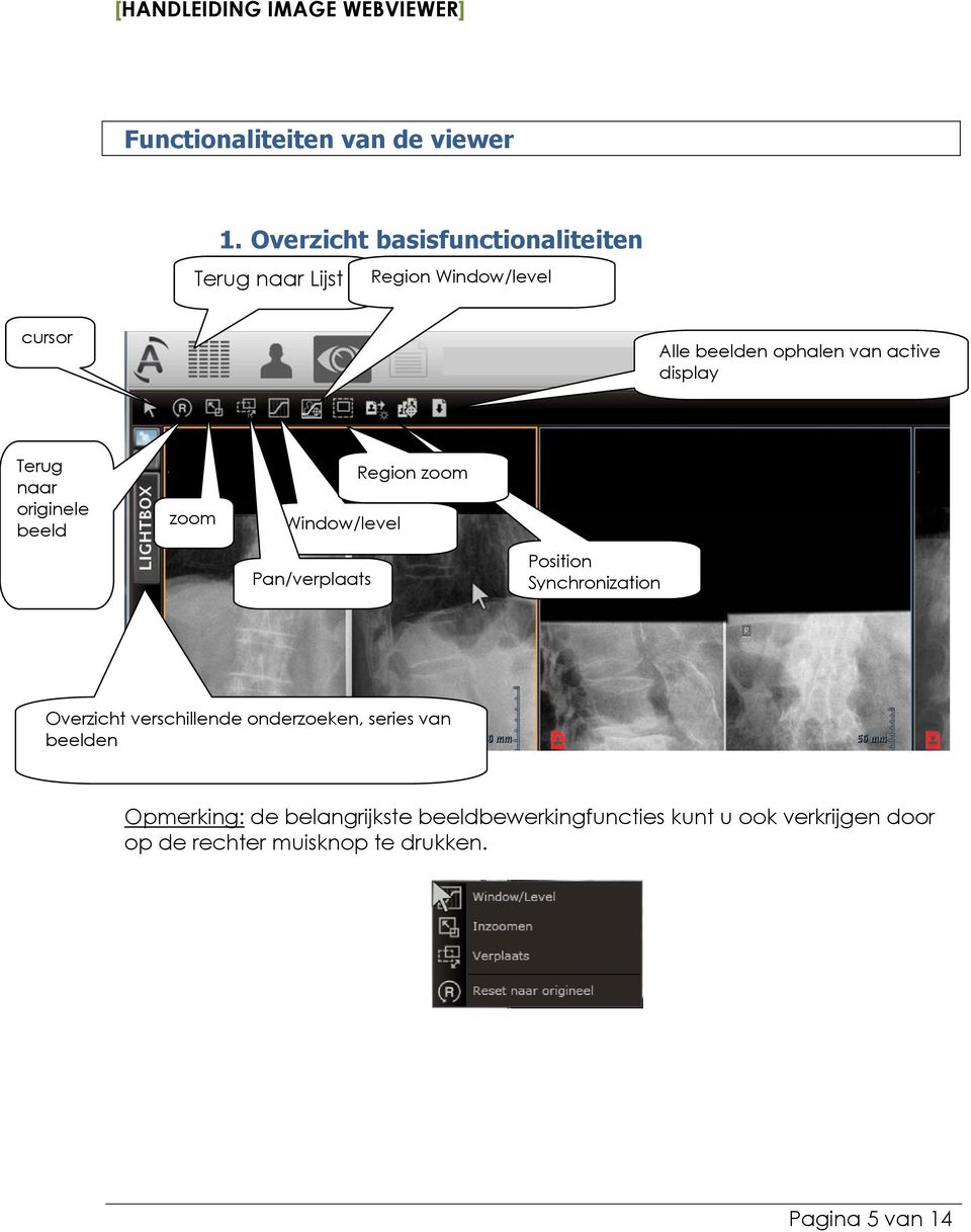 active display Terug naar originele beeld zoom Window/level Pan/verplaats Region zoom Position