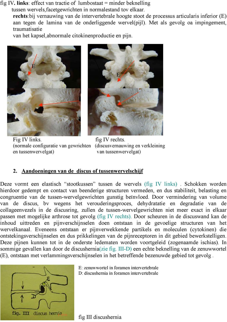 Met als gevolg oa impingement, traumatisatie van het kapsel,abnormale citokinenproductie en pijn. Fig Fig IV links. fig IV rechts.