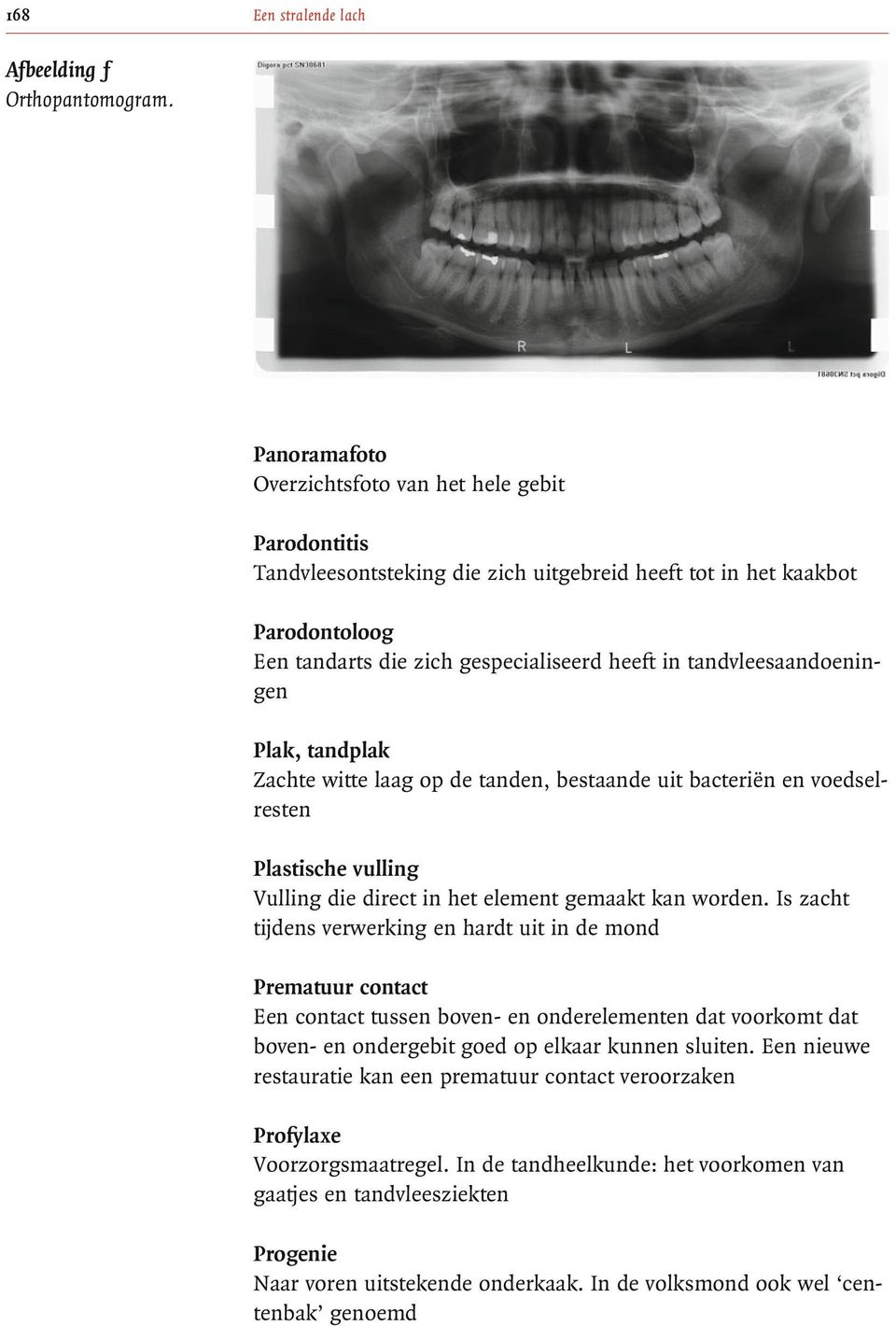 tandvleesaandoeningen Plak, tandplak Zachte witte laag op de tanden, bestaande uit bacteriën envoedselresten Plastische vulling Vulling die direct in het element gemaakt kan worden.