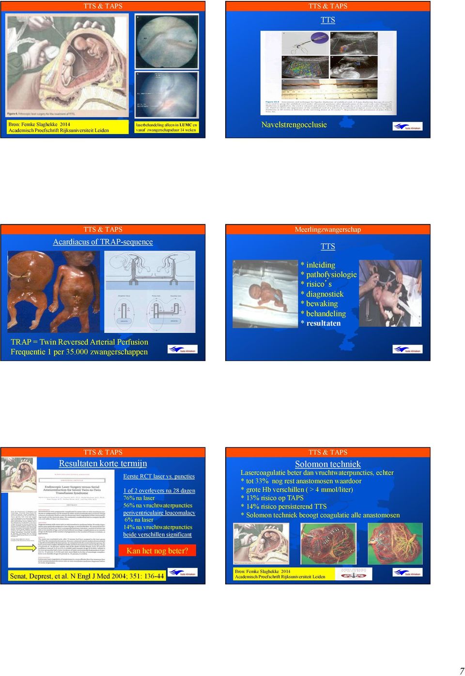 puncties 1 of 2 overlevers na 28 dagen 76% na laser 56% na vruchtwaterpuncties periventriculaire leucomalacy 6% na laser 14% na vruchtwaterpuncties beide verschillen significant Solomon techniek