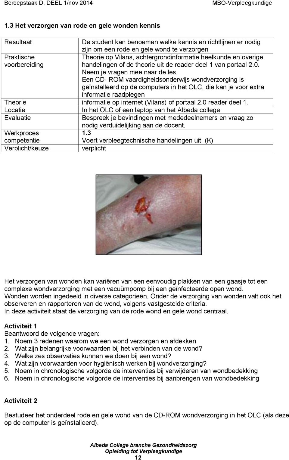 Een CD- ROM vaardigheidsonderwijs wondverzorging is geïnstalleerd op de computers in het OLC, die kan je voor extra informatie raadplegen Theorie informatie op internet (Vilans) of portaal 2.