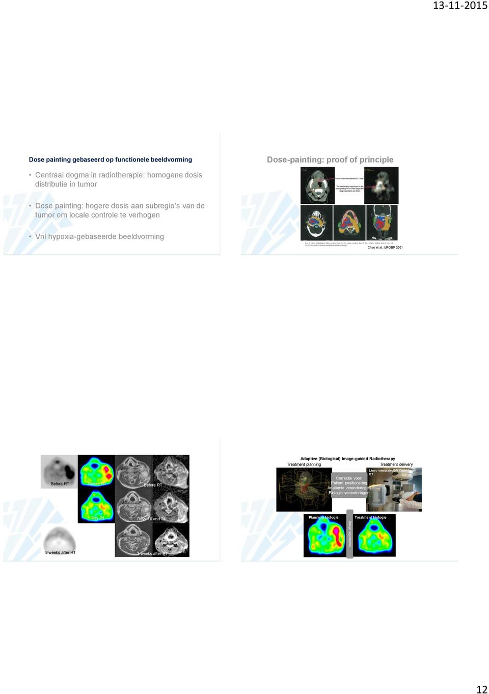 (Biological) Image-guided Radiotherapy Treatment planning Treatment delivery Before RT Before RT Before RT Linac-integrated kv Cone-beam CT Correctie voor: Patient