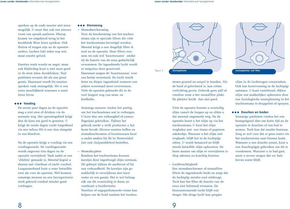 fluiten of zingen zijn na de operatie Meestal krijgt u een dergelijk filter al anders. Lachen lukt zeker nog wel, snel na de operatie. Deze filters noe - maar zonder geluid.