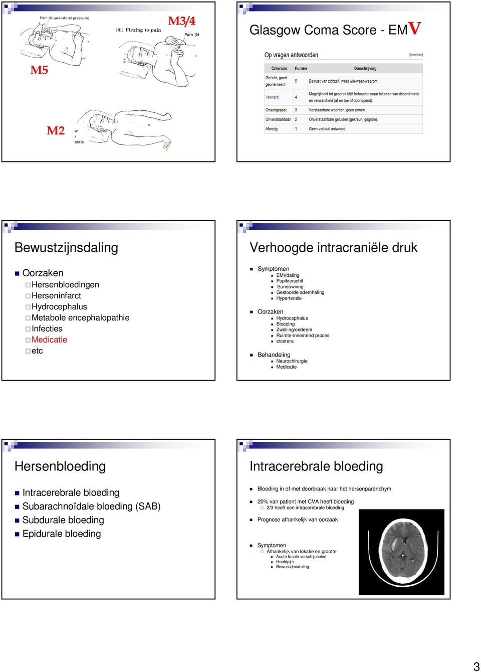 Hersenbloeding Intracerebrale bloeding Subarachnoïdale bloeding (SAB) Subdurale bloeding Epidurale bloeding Intracerebrale bloeding Bloeding in of met doorbraak naar het hersenparenchym 20%