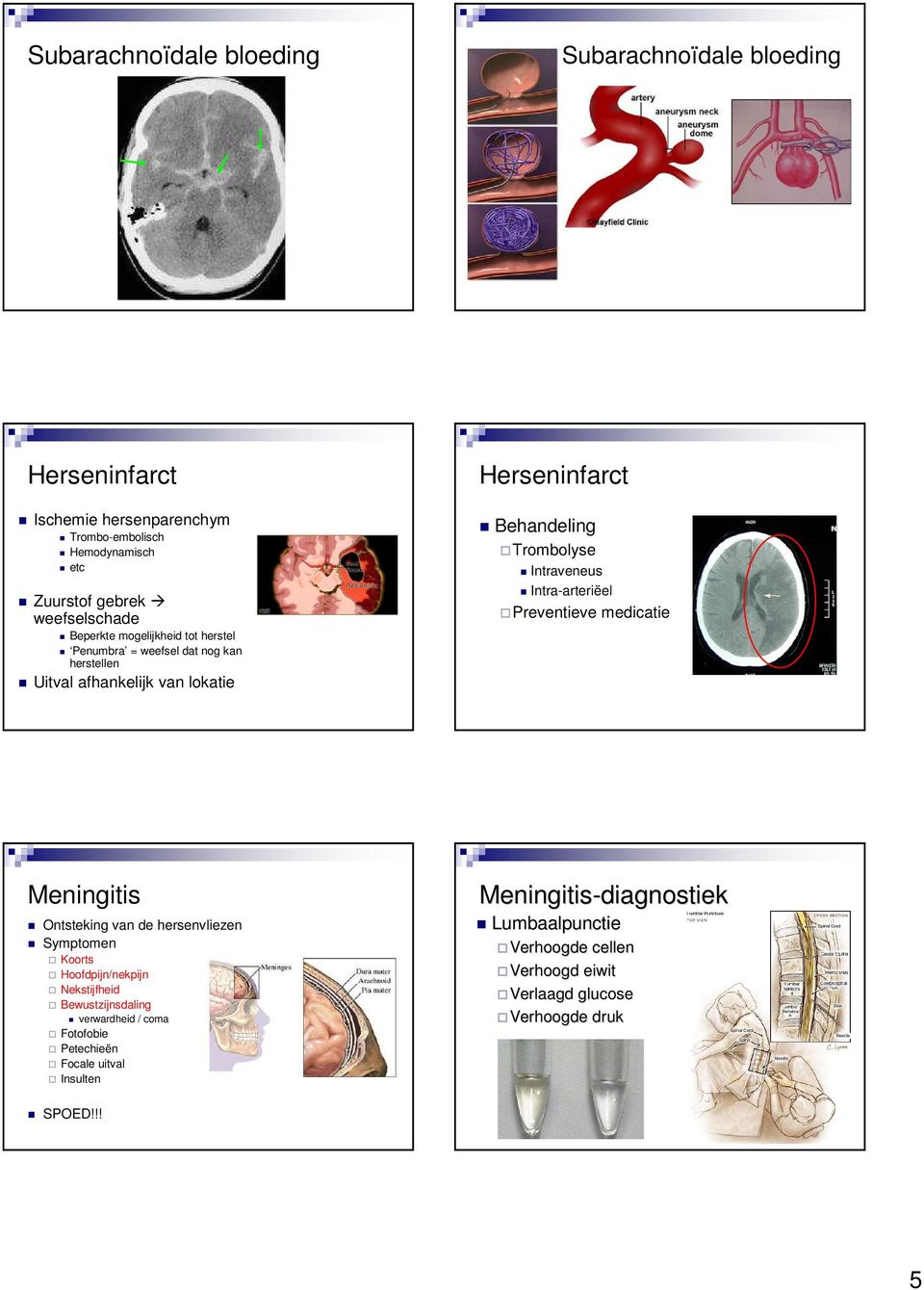Intra-arteriëel Preventieve medicatie Meningitis Ontsteking van de hersenvliezen Symptomen Koorts Hoofdpijn/nekpijn Nekstijfheid Bewustzijnsdaling