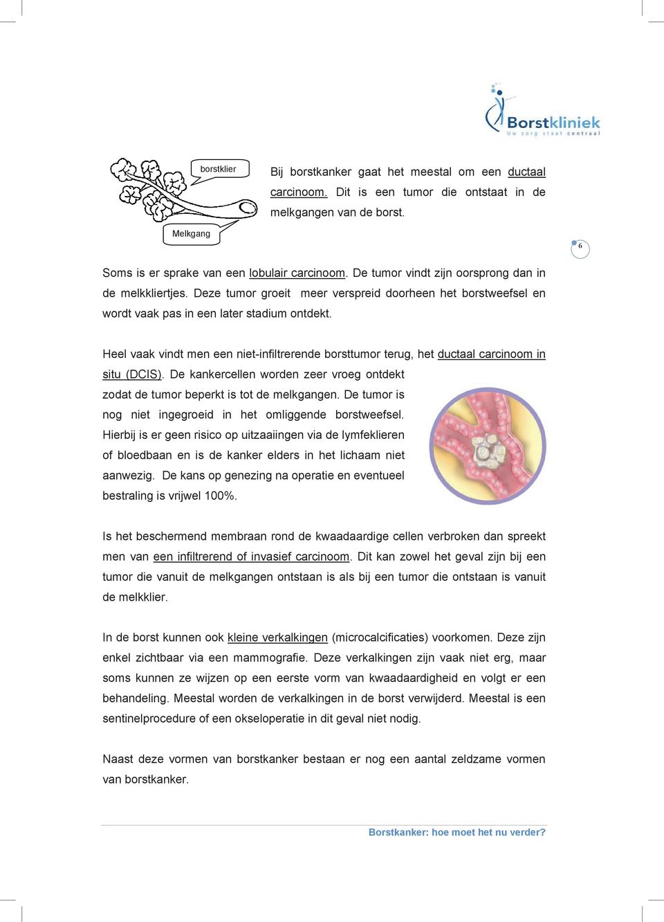 Heel vaak vindt men een niet-infiltrerende borsttumor terug, het ductaal carcinoom in situ (DCIS). De kankercellen worden zeer vroeg ontdekt zodat de tumor beperkt is tot de melkgangen.