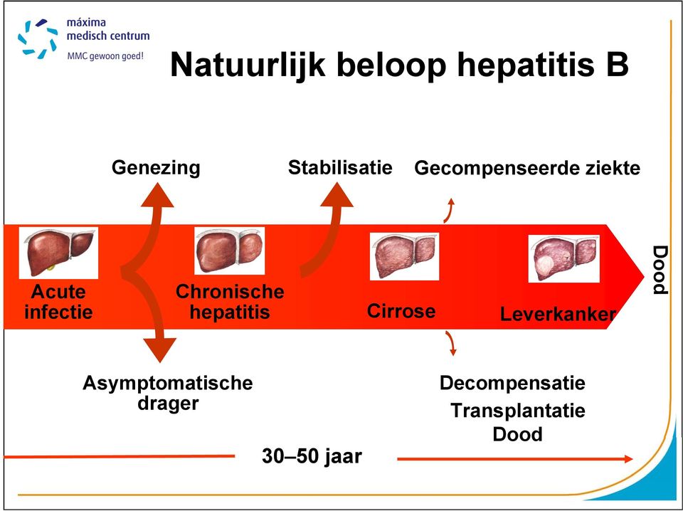 Chronische hepatitis Cirrose Leverkanker