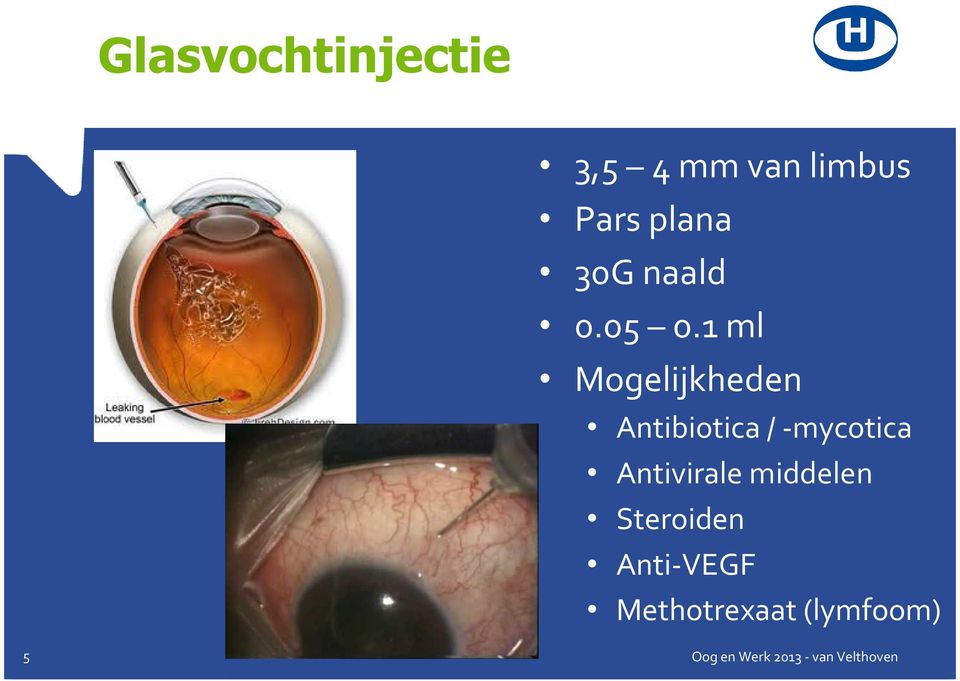 1 ml Mogelijkheden Antibiotica /-mycotica