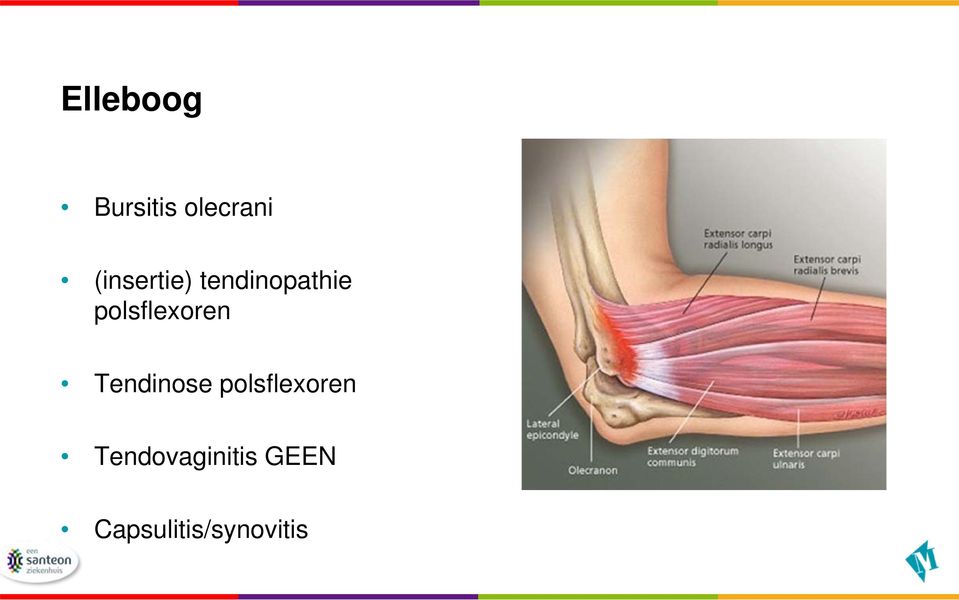 polsflexoren Tendinose