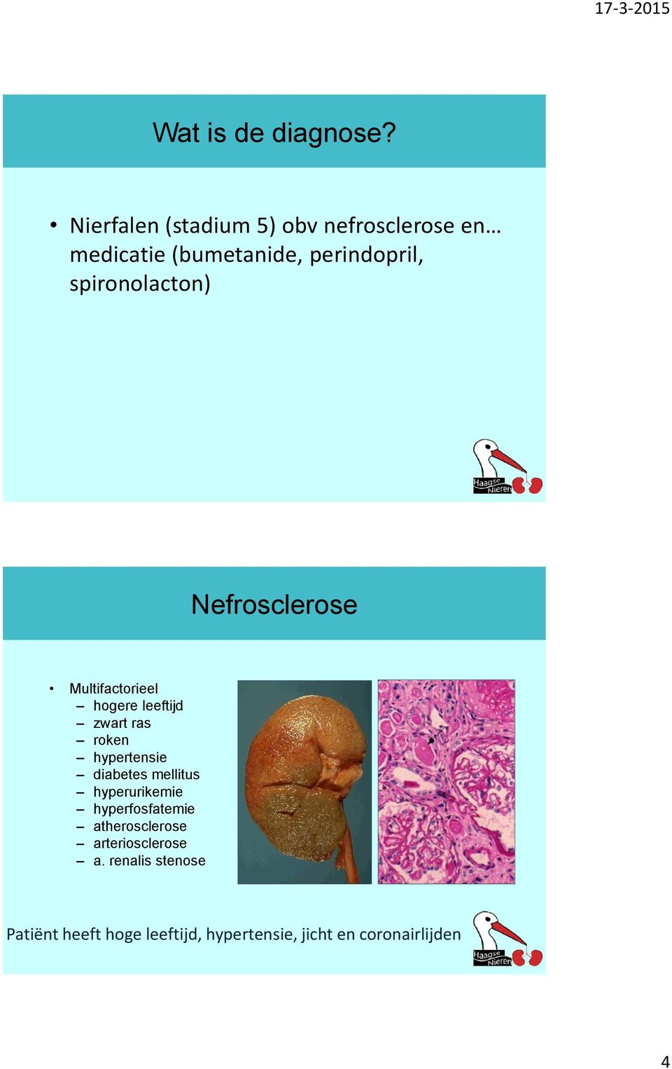 spironolacton) Nefrosclerose Multifactorieel hogere leeftijd zwart ras roken hypertensie