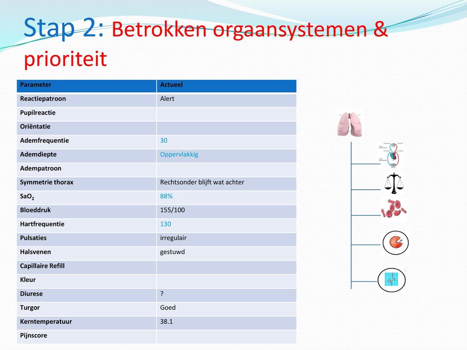 thorax Rechtsonder blijft wat achter SaO 2 88% Bloeddruk 155/100 Hartfrequentie 130