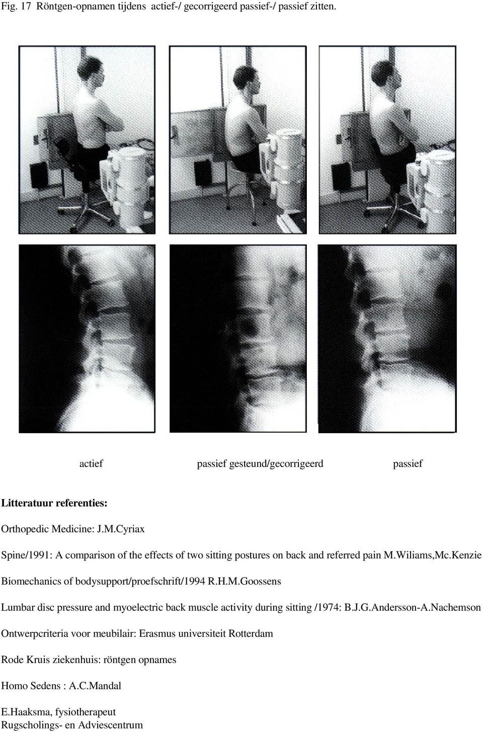 dicine: J.M.Cyriax Spine/1991: A comparison of the effects of two sitting postures on back and referred pain M.Wiliams,Mc.