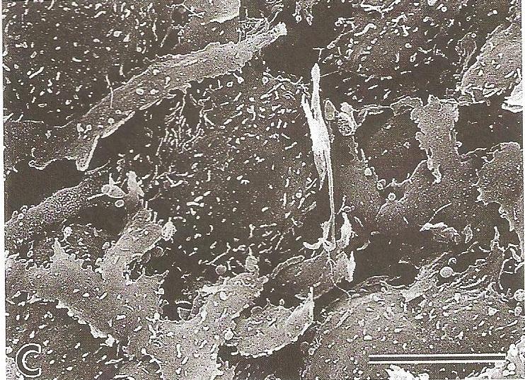 d. De regio gericht naar de huid De intima van het pariëtaal en het visceraal blad in de regio van de sesamschede die gericht is naar de huid (Fig. 13) is zeer dun en effen.
