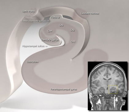 Nieuwe MI technieken in dementie diagnostiek Aad van der ugt Dementie M imaging MI > CT MI is geindiceerd tijdens diagnostische work-up Conventionele M imaging (Parelsnoer protocol) T1w (3D) FAI /