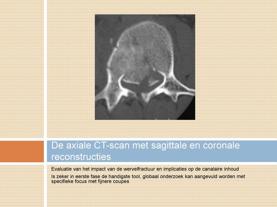 de canalaire inhoud Is zeker in eerste fase de handigste tool,