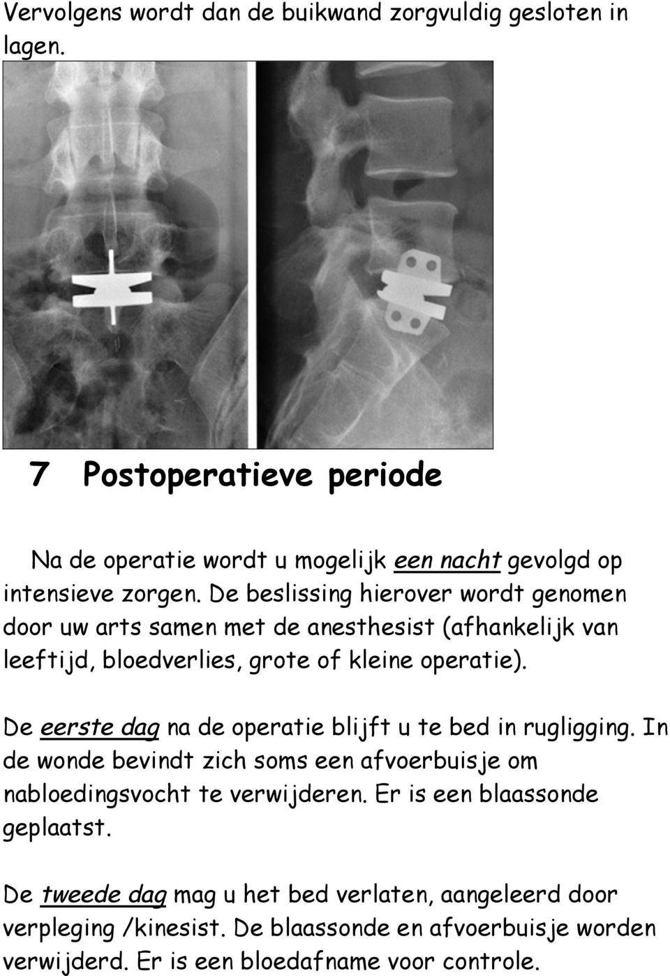 De eerste dag na de operatie blijft u te bed in rugligging. In de wonde bevindt zich soms een afvoerbuisje om nabloedingsvocht te verwijderen.