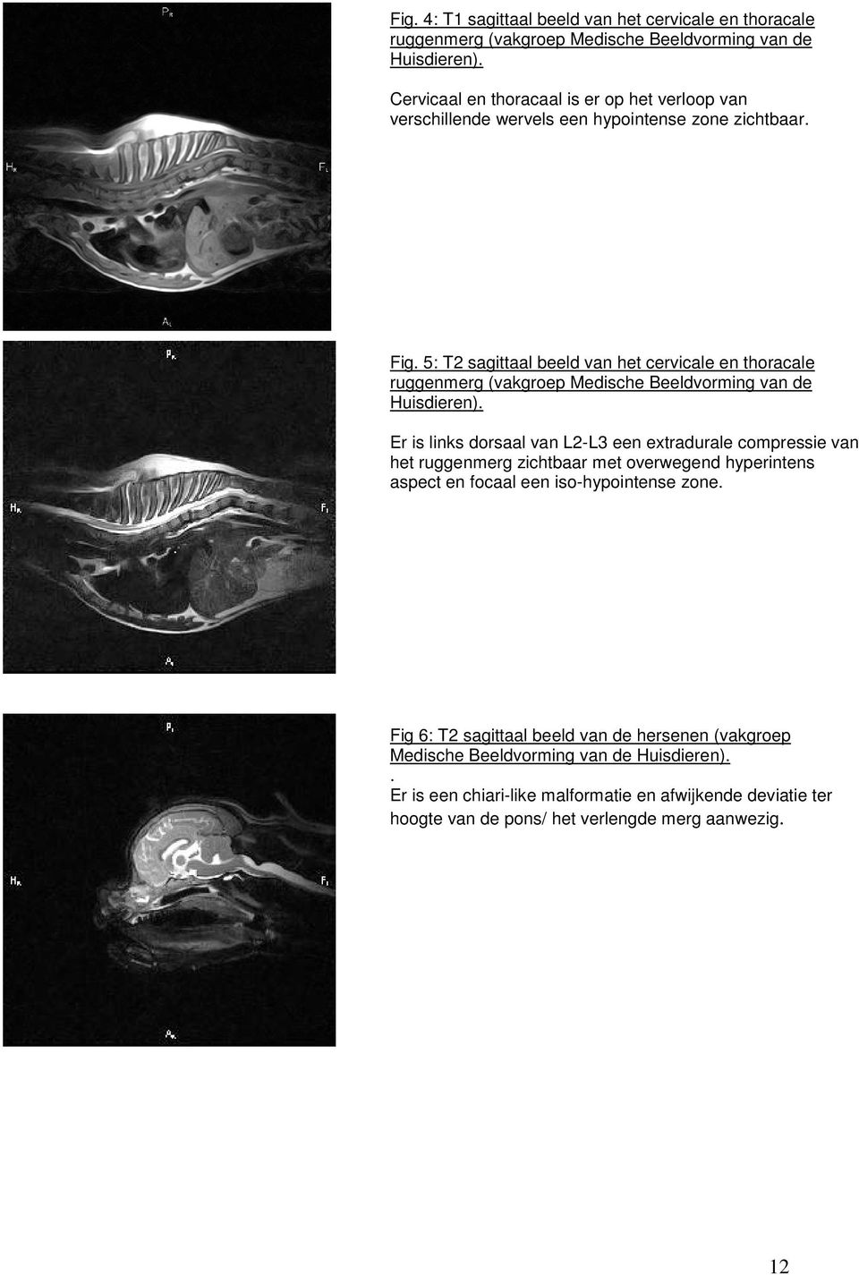 5: T2 sagittaal beeld van het cervicale en thoracale ruggenmerg (vakgroep Medische Beeldvorming van de Huisdieren).