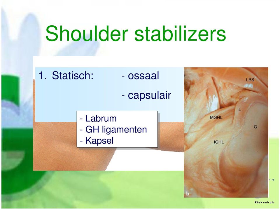 - capsulair --Labrum