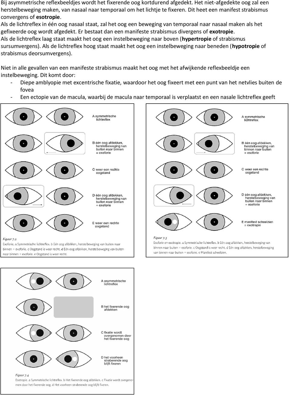 Er bestaat dan een manifeste strabismus divergens of exotropie. Als de lichtreflex laag staat maakt het oog een instelbeweging naar boven (hypertropie of strabismus sursumvergens).