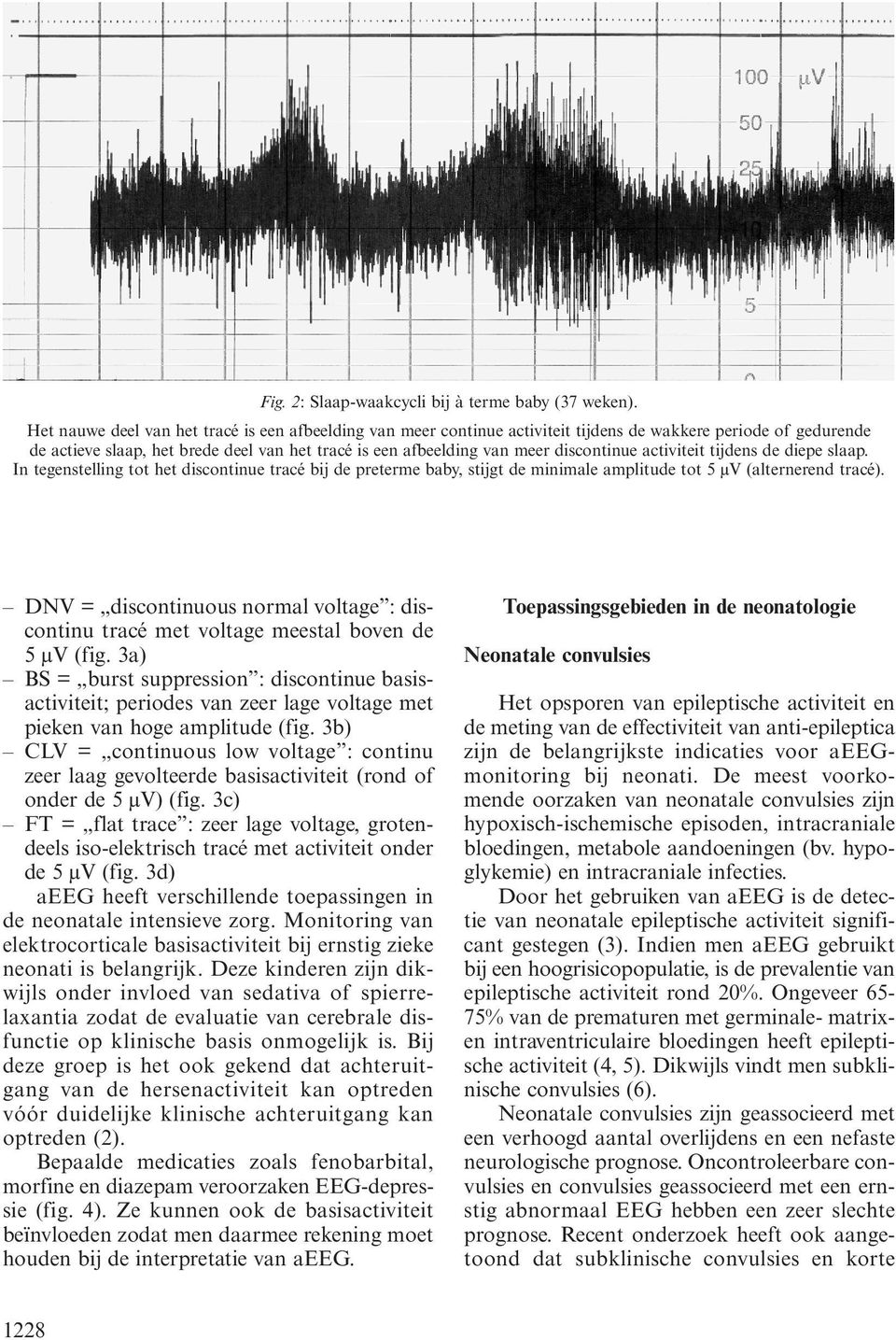 discontinue activiteit tijdens de diepe slaap. In tegenstelling tot het discontinue tracé bij de preterme baby, stijgt de minimale amplitude tot 5 µv (alternerend tracé).