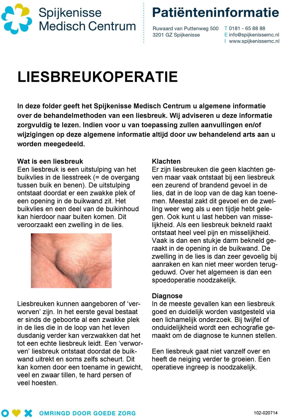 Wat is een liesbreuk Een liesbreuk is een uitstulping van het buikvlies in de liesstreek (= de overgang tussen buik en benen).