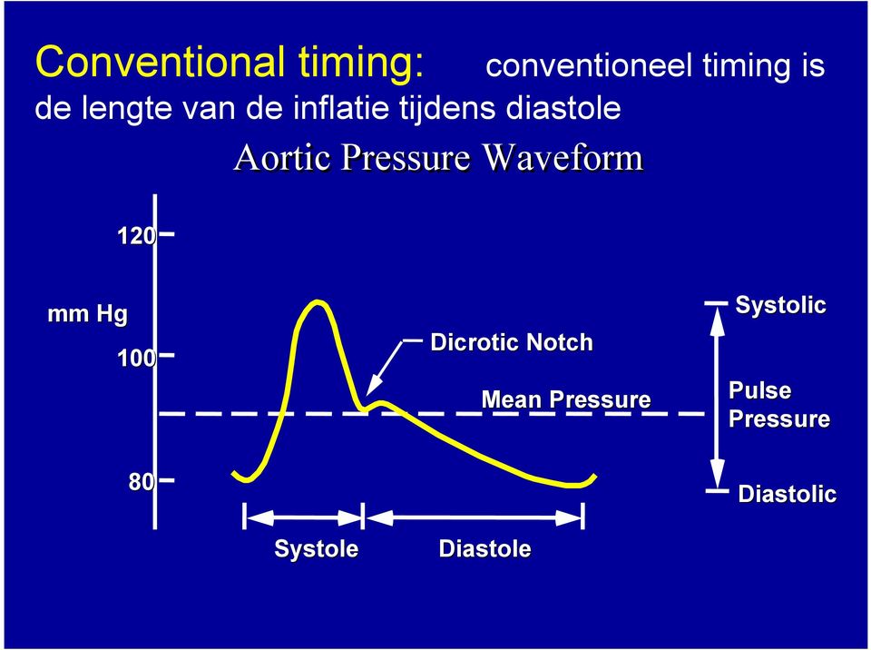 Pressure Waveform mm Hg 100 80 Dicrotic Notch Mean