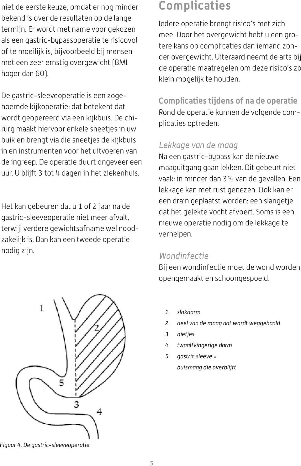 De gastric-sleeveoperatie is een zogenoemde kijkoperatie: dat betekent dat wordt geopereerd via een kijkbuis.