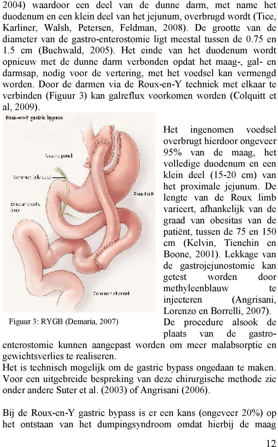 Het einde van het duodenum wordt opnieuw met de dunne darm verbonden opdat het maag-, gal- en darmsap, nodig voor de vertering, met het voedsel kan vermengd worden.