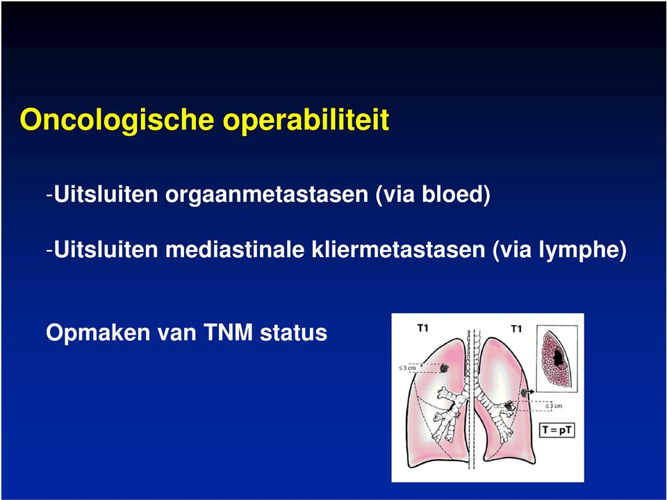 bloed) -Uitsluiten mediastinale