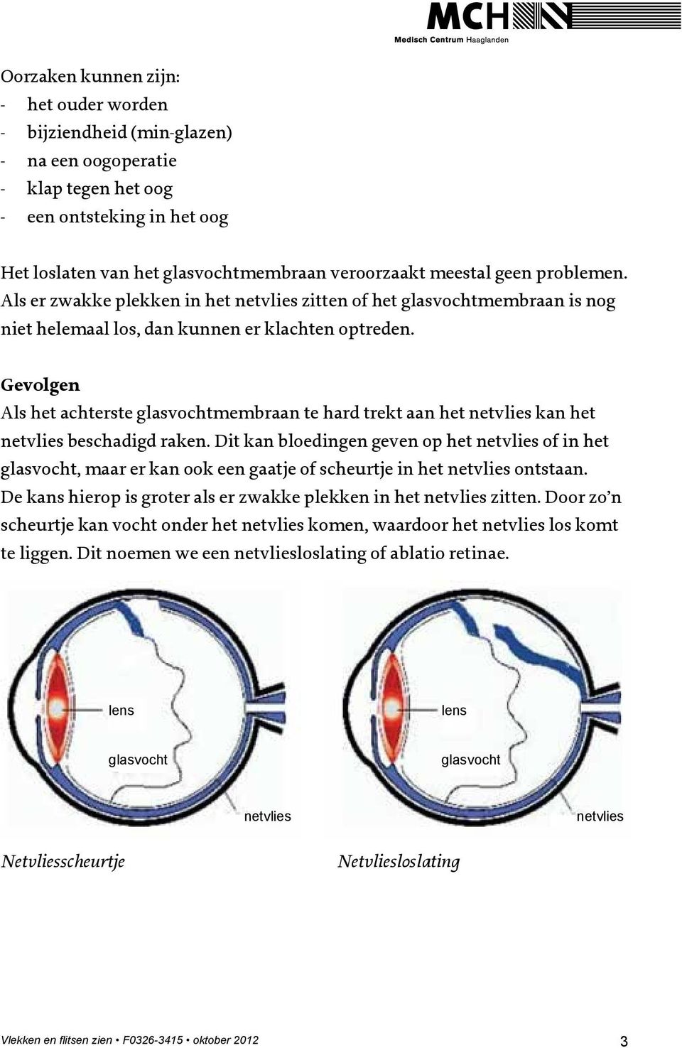 Gevolgen Als het achterste membraan te hard trekt aan het kan het beschadigd raken. Dit kan bloedingen geven op het of in het, maar er kan ook een gaatje of scheurtje in het ontstaan.