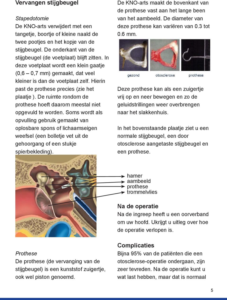 Hierin past de prothese precies (zie het plaatje ). De ruimte rondom de prothese hoeft daarom meestal niet opgevuld te worden.