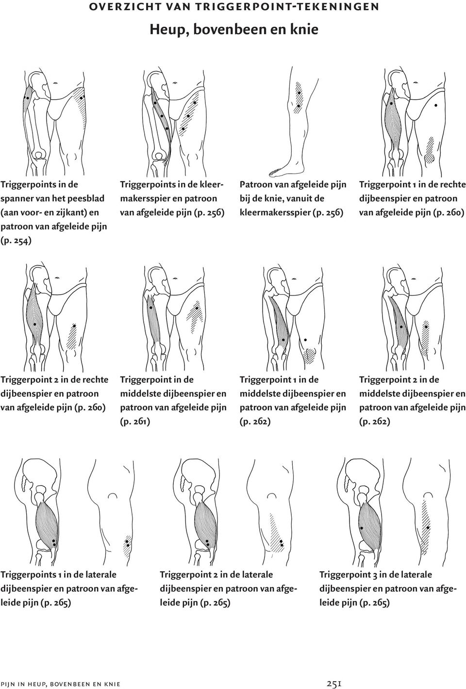 256) Triggerpoint 1 in de rechte dijbeenspier en patroon van afgeleide pijn (p. 260) Triggerpoint 2 in de rechte dijbeenspier en patroon van afgeleide pijn (p.