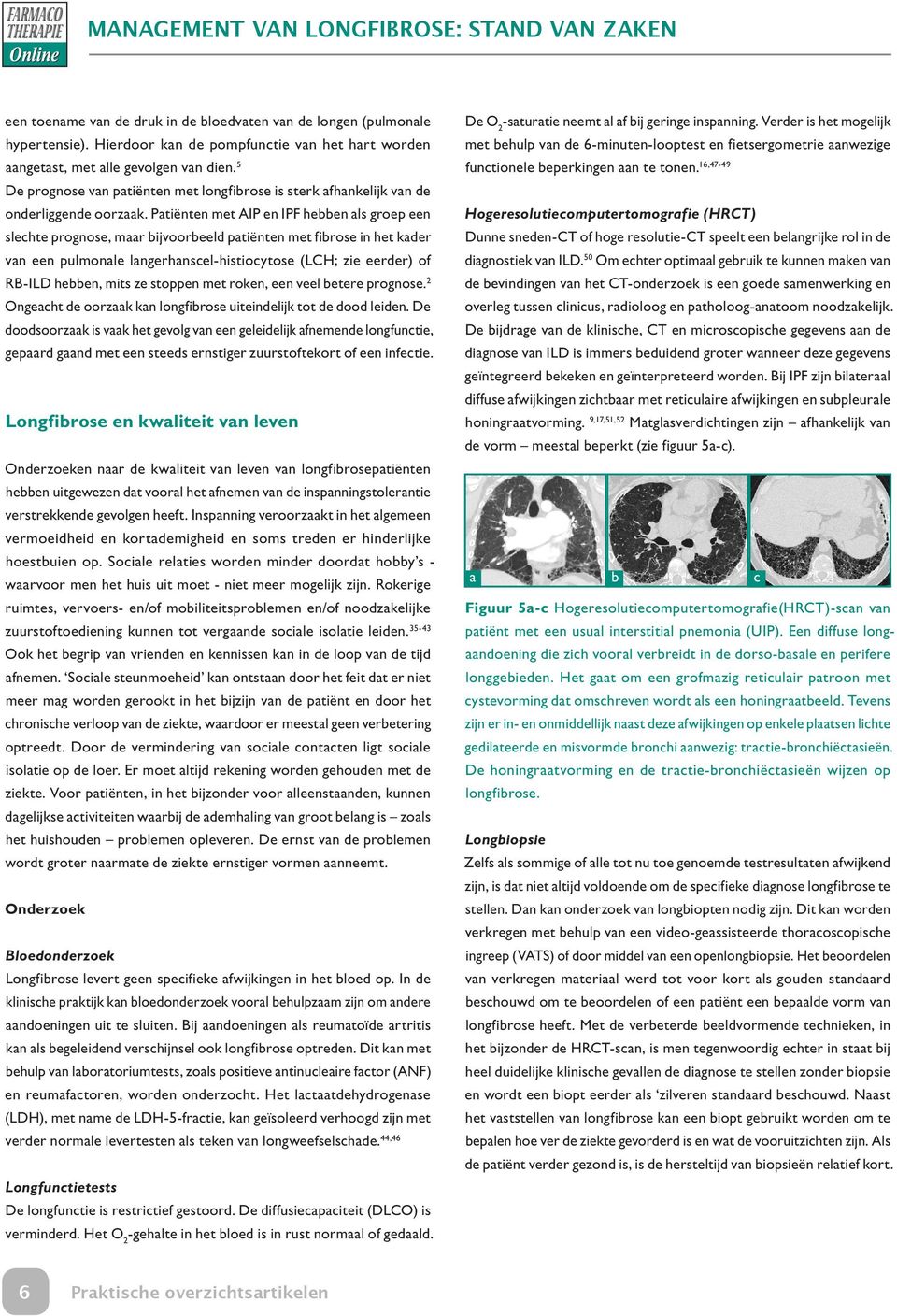 Patiënten met AIP en IPF hebben als groep een slechte prognose, maar bijvoorbeeld patiënten met fibrose in het kader van een pulmonale langerhanscel-histiocytose (LCH; zie eerder) of RB-ILD hebben,