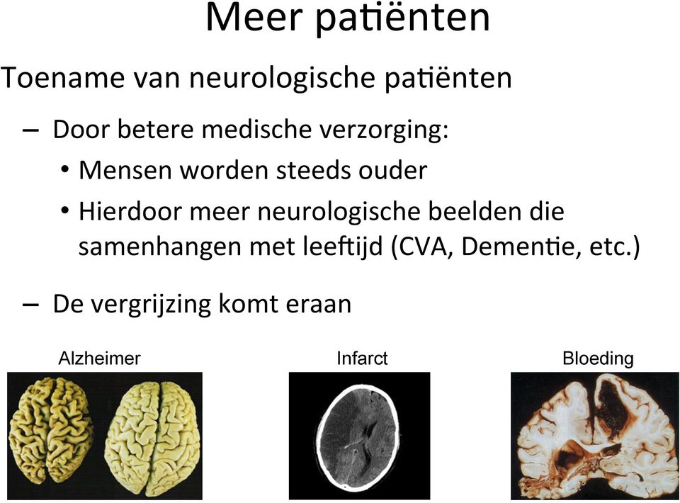 neurologische beelden die samenhangen met leerijd (CVA,