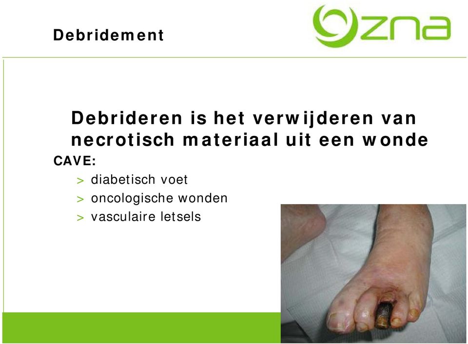 uit een wonde CAVE: > diabetisch voet