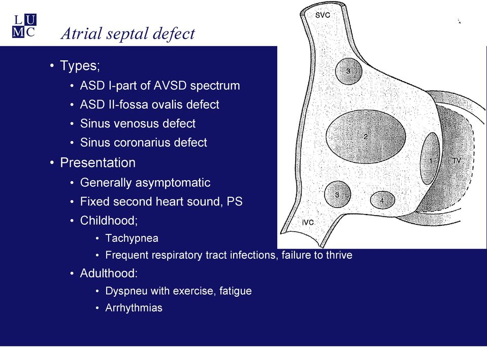 asymptomatic Fixed second heart sound, PS Childhood; Tachypnea Frequent