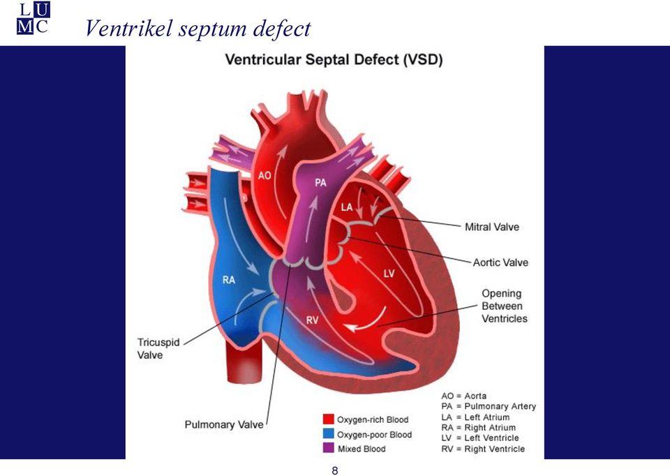 defect 8