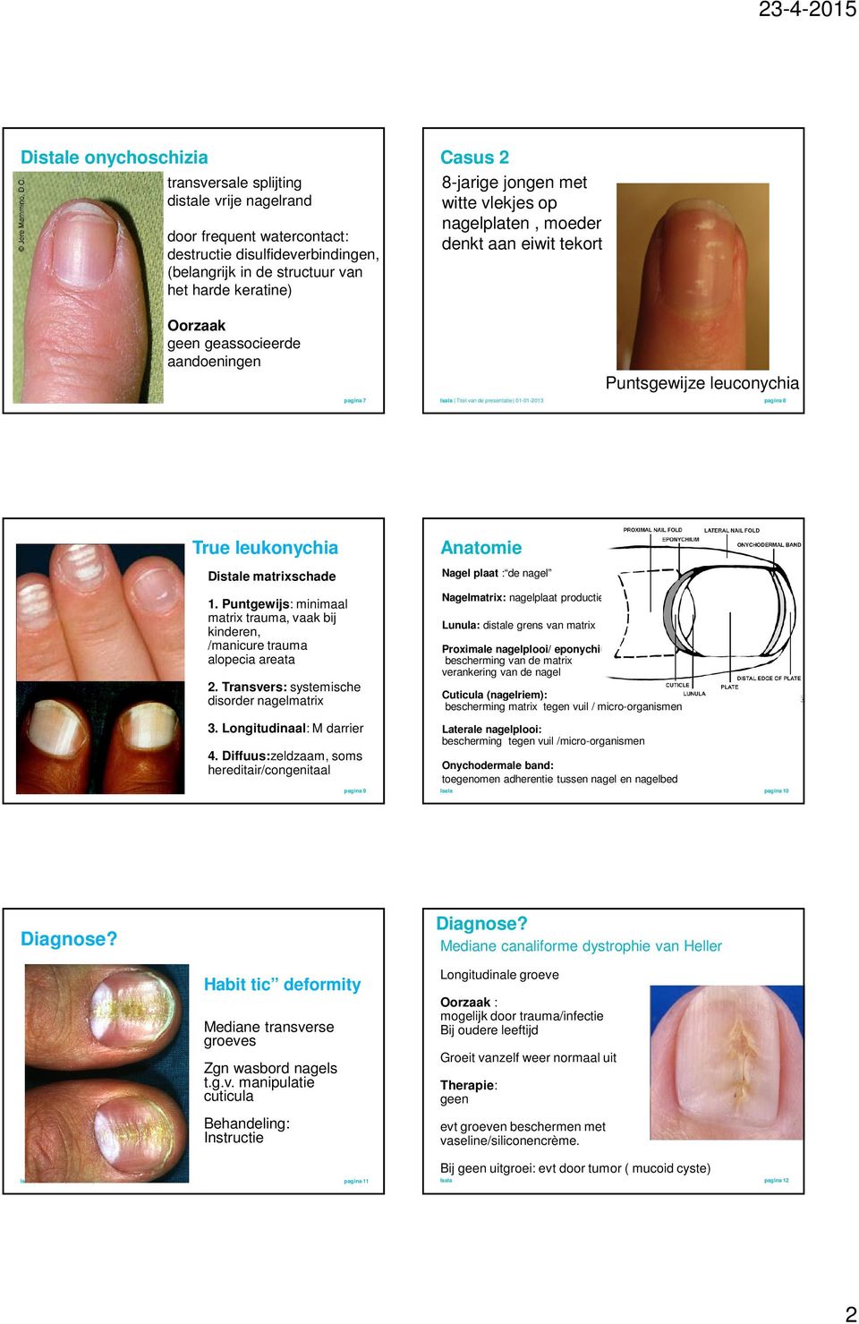 Titel van de presentatie 01-01-2013 pagina 8 True leukonychia Distale matrixschade 1. Puntgewijs: minimaal matrix trauma, vaak bij kinderen, /manicure trauma alopecia areata 2.