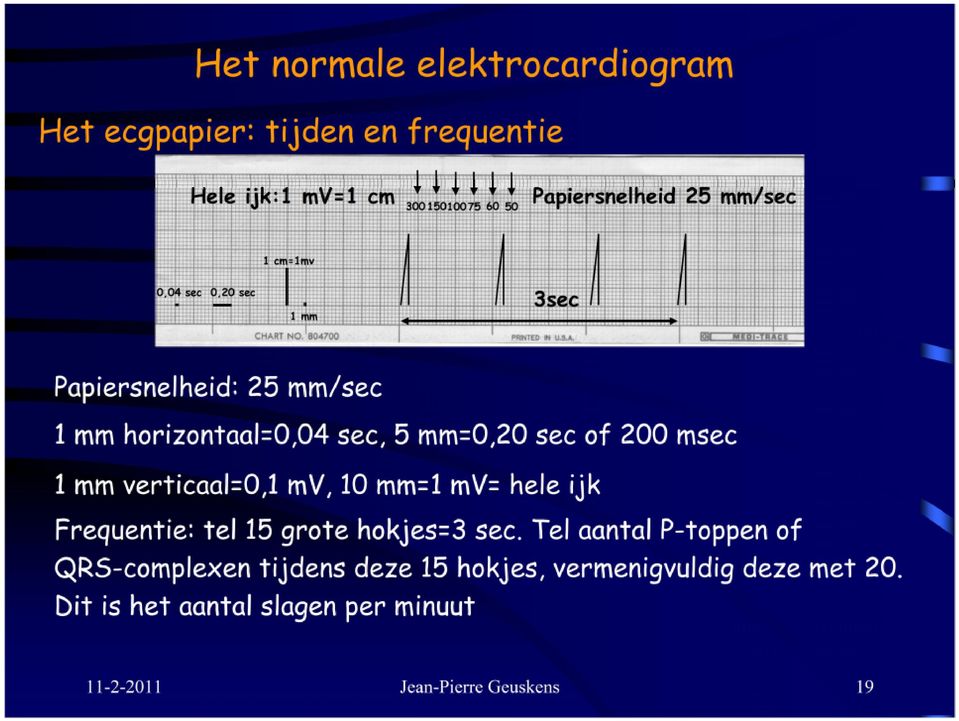 200 msec 1 mm verticaal=0,1 mv, 10 mm=1 mv= hele ijk Frequentie: tel 15 grote hokjes=3 sec.