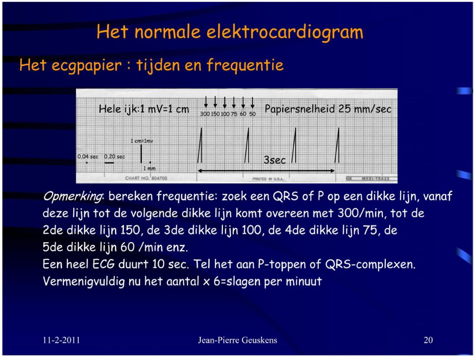 komt overeen met 300/min, tot de 2de dikke lijn 150, de 3de dikke lijn 100, de 4de dikke lijn 75, de 5de dikke lijn 60 /min