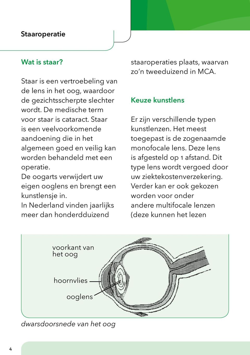 In Nederland vinden jaarlijks meer dan honderdduizend staaroperaties plaats, waarvan zo n tweeduizend in MCA. Keuze kunstlens Er zijn verschillende typen kunstlenzen.