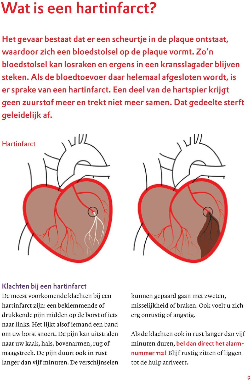 Een deel van de hartspier krijgt geen zuurstof meer en trekt niet meer samen. Dat gedeelte sterft geleidelijk af.